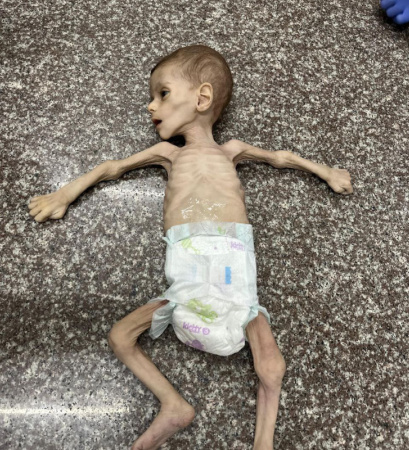 Les agences de l'ONU avertissent : Gaza est au bord de la famine