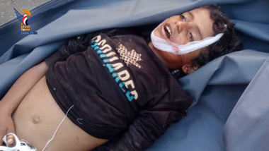 Märtyrertod eines Kindes durch eine durch Söldnern der Aggression abgefeuerte Granate auf das Dorf Al-Kama im Distrikt Maqbanah in Taiz