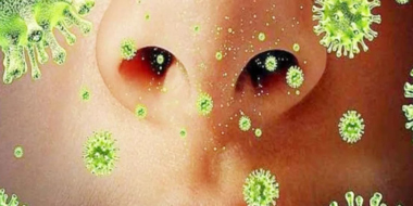 WHO recommends implementing measures to prevent middle east respiratory syndrome