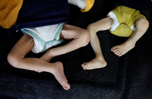 Gaza Health warns of unprecedented surge in acute flaccid paralysis cases